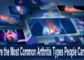What Are the Most Common Arthritis Types People Can Have?