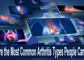 What Are the Most Common Arthritis Types People Can Have?