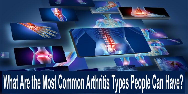 What Are the Most Common Arthritis Types People Can Have?