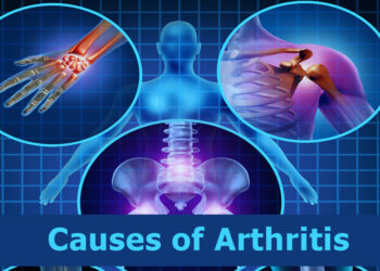 Causes of Arthritis