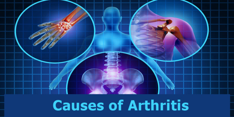 Causes of Arthritis