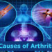 Causes of Arthritis